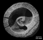 Heteropsammia cochlea, transverse section