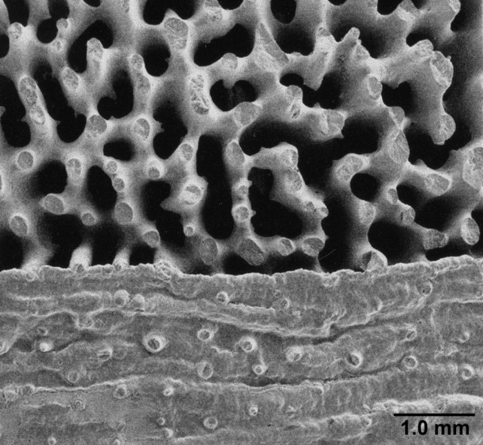 Bathypsammia tintinnabulum, hispid theca