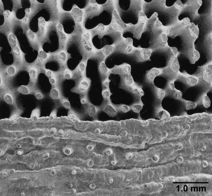 Bathypsammia tintinnabulum, hispid theca Bathypsammia tintinnabulum, hispid theca