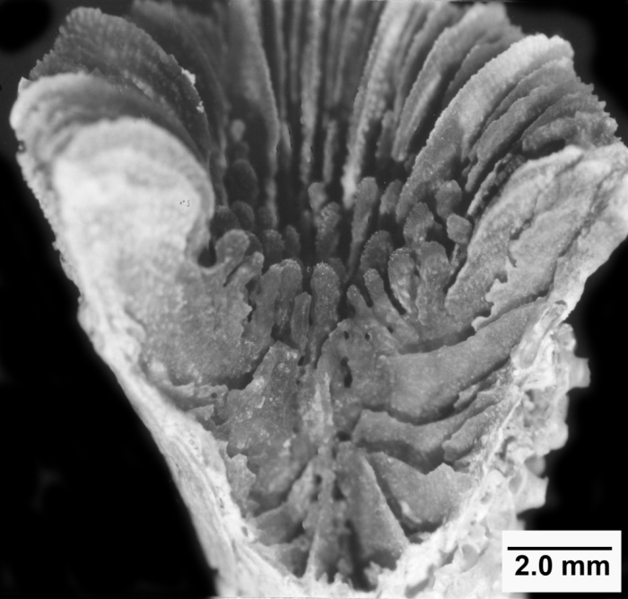 Paracyathus stearnsii