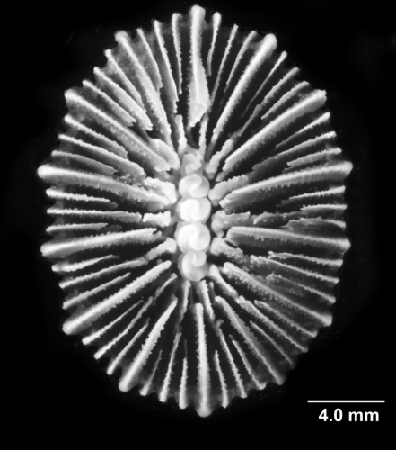 Acanthocyathus grayi,calicular view