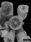 Lochmaeotrochus oculeus, corallites from same colony