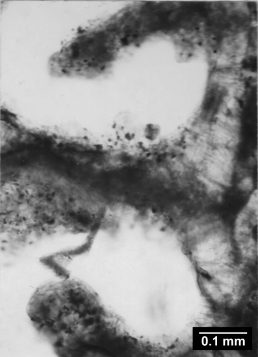Pourtalocyathus hispidus (Pourtalès, 1878), transverse thin-section through three septa of calice. Pourtalocyathus hispidus (Pourtalès, 1878), transverse thin-section through three septa of calice.
