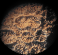 Anthozoa