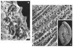 Chromista - Foraminifera (foraminifers)