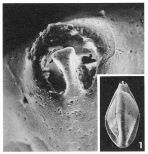 Triloculina pseudohemisphaerica Le Calvez, 1947