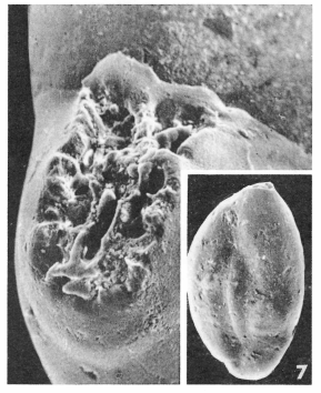 Miliola robusta Le Calvez, 1947