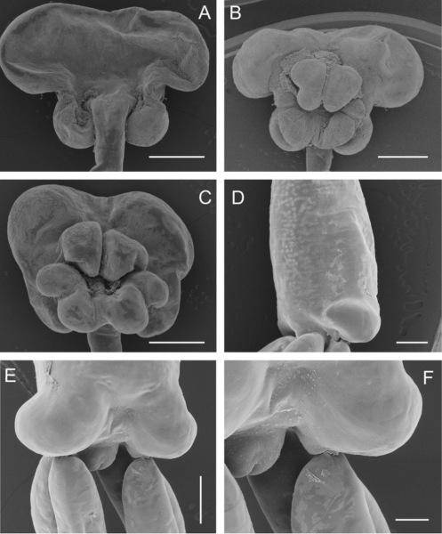 Tripaphylus squidwardi Boxshall, Barton, Kirke, Zhu & Johnson, 2022