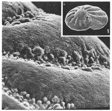 Elphidium laeve (d'Orbigny in Parker, Jones & Brady, 1865)