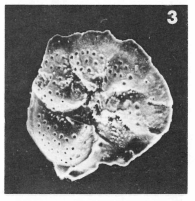 Discorbis rotata (Terquem, 1882) Discorbis rotata (Terquem, 1882)