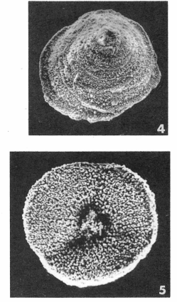 Glabratella turbinata (Terquem, 1882)