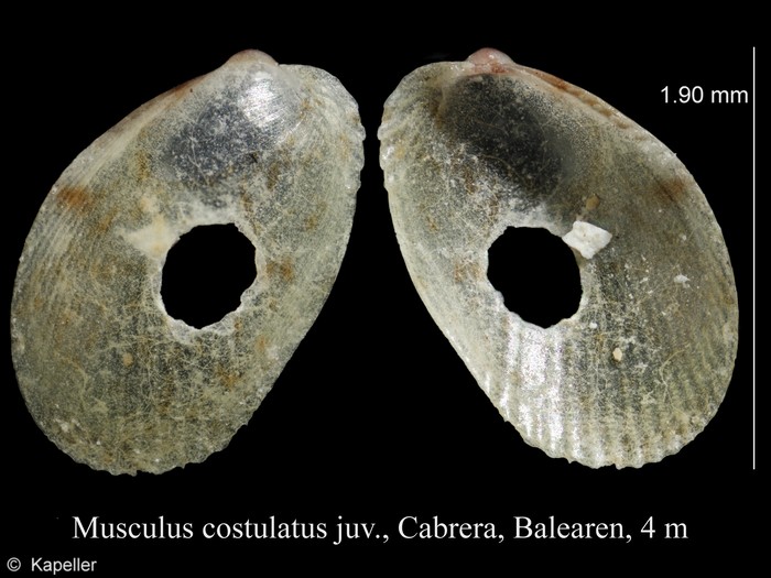 Musculus costulatus Musculus costulatus
