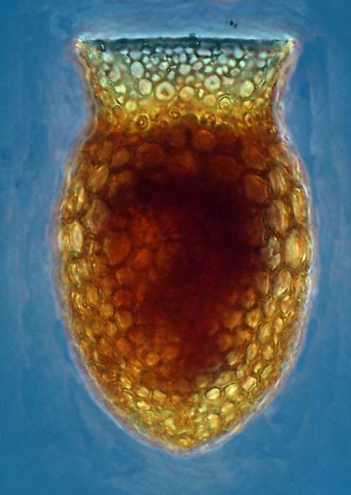 Codonella elongata Codonella elongata