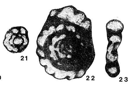 Septatournayella rauserae Lipina, 1955