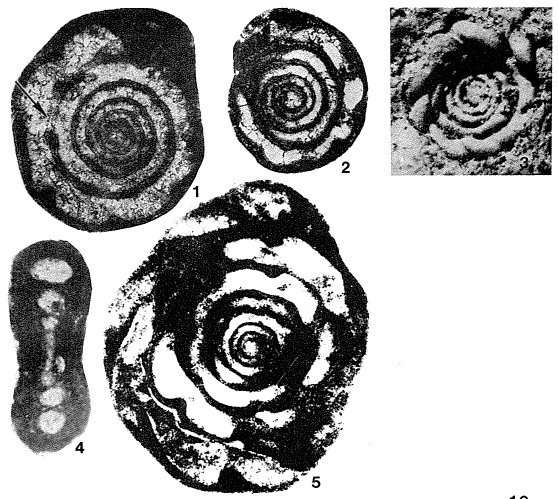 Septatournayella henbesti Skipp, 1966 Septatournayella henbesti Skipp, 1966