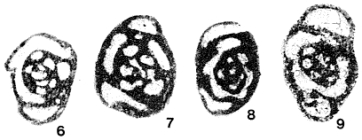Neoseptaglomospiranella dainae (Lipina, 1955)
