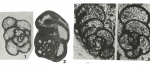 Chromista - Foraminifera (foraminifers)