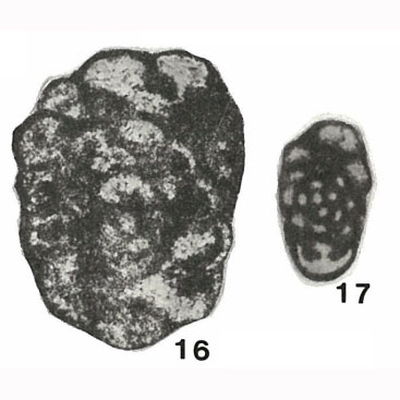 Endothyra communis Rauzer-Chernousova, 1948 Endothyra communis Rauzer-Chernousova, 1948