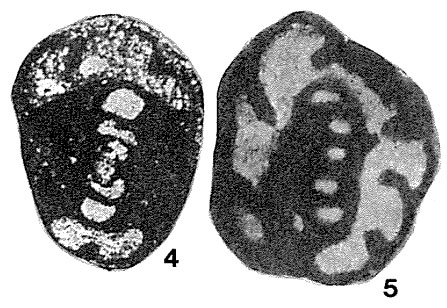 Endothyra fomichaensis Lebedeva, 1954