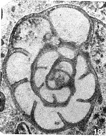 Semiendothyra surenica Reitlinger, 1980