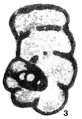 Mikhailovella gracilis (Rauzer-Chernousova, 1948) Mikhailovella gracilis (Rauzer-Chernousova, 1948)