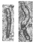 Chromista - Foraminifera (foraminifers)