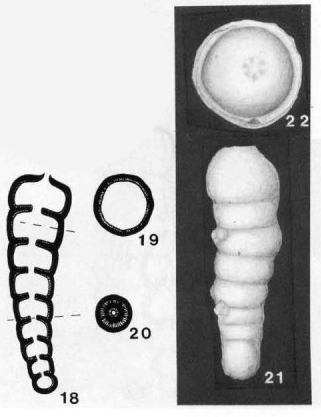 Nodosinella digitata Brady, 1876 Nodosinella digitata Brady, 1876