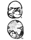Paraglobivalvulina mira Reitlinger, 1965