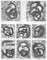 Tenebrosella asturica Villa & Sánchez de Posada, 1986