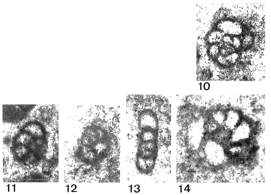 Endotriada tyrrhenica Vachard, Martini, Rettori & Zaninetti, 1994