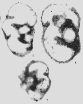 Spinotournayellina costifera Wu in Wu & Liao, 2001