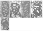 Chromista - Foraminifera (foraminifers)