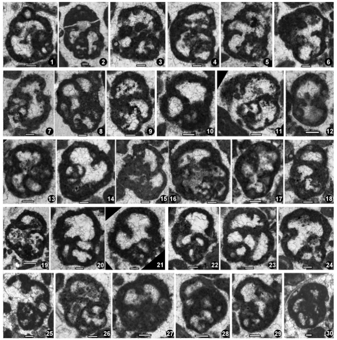 Praekoktjubina yindagindyensis Vachard, Haig &amp; Mory, 2014