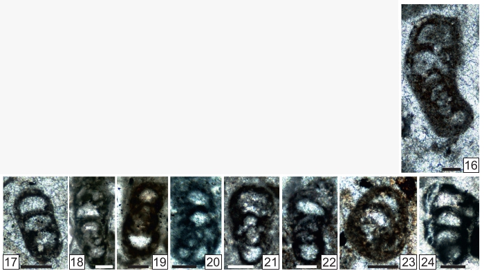 Rectoendoteba tieni Vachard in Krainer, Vachard & Schaffhauser, 2019 Rectoendoteba tieni Vachard in Krainer, Vachard & Schaffhauser, 2019