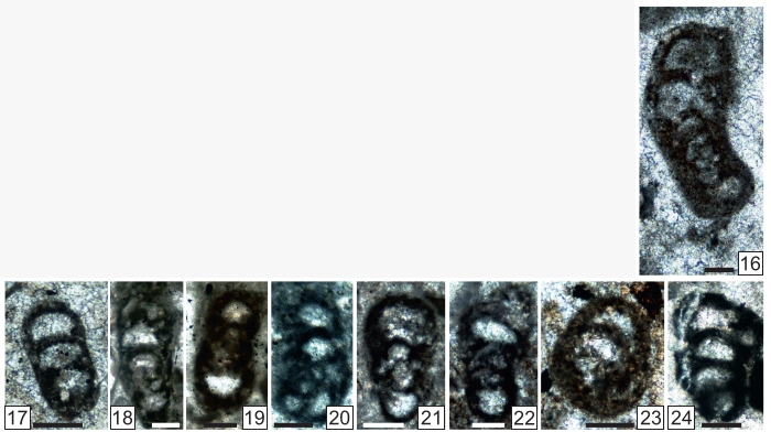 Rectoendoteba tieni Vachard in Krainer, Vachard & Schaffhauser, 2019