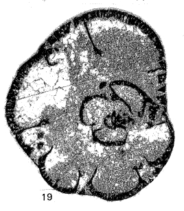 Pseudojanischewskina multicribrata Mamet & Pinard, 1992