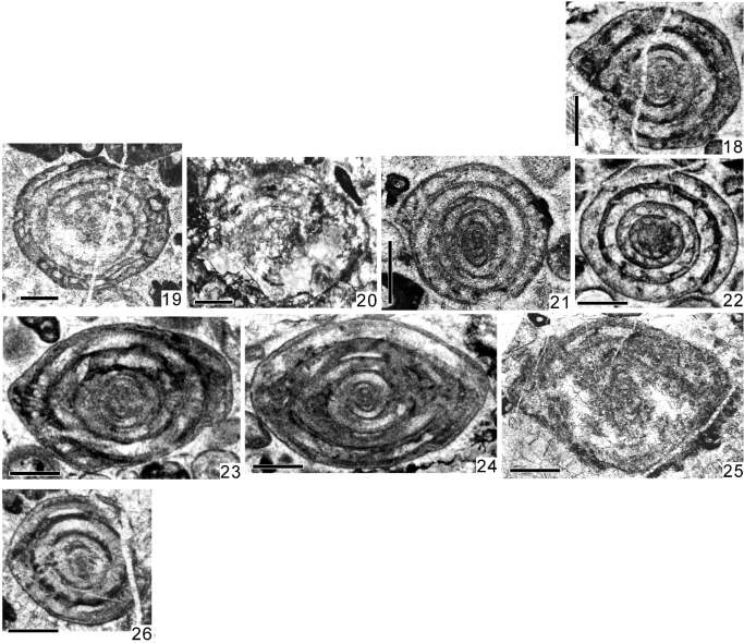 Tsukumiella tsukumiensis Kobayashi, 2013 Tsukumiella tsukumiensis Kobayashi, 2013