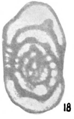 Pseudostaffella ziganica Sinitsyna in Stepanov et al., 1975 Pseudostaffella ziganica Sinitsyna in Stepanov et al., 1975