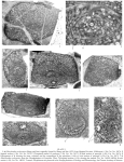 Chromista - Foraminifera (foraminifers)