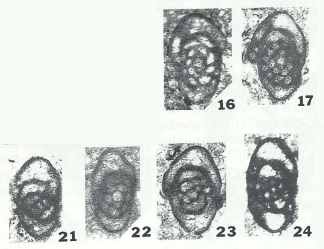 Endostaffella asymmetrica Rozovskaya, 1963 Endostaffella asymmetrica Rozovskaya, 1963