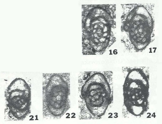 Endostaffella asymmetrica Rozovskaya, 1963