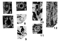 Tezaquina clivuli Vachard, 1980