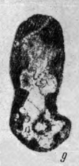 Chernyshinella (Rectochernyshinella) distorta Lipina, 1965 Chernyshinella (Rectochernyshinella) distorta Lipina, 1965