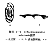 Septagathammina hubeiensis Lin, 1984