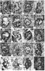 Halevikia deveciae Özkan & Vachard, 2015