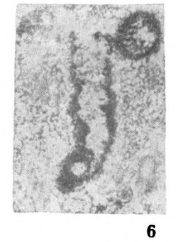 Paracaligella (Glubokoevella) acuta Pronina, 1970