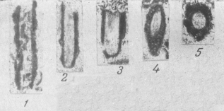 Hyperammina sibirica Lipina, 1959 Hyperammina sibirica Lipina, 1959