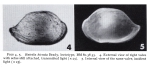 Lectotype of Bairdia hirsuta Brady, 1880 (fig from Puri & Hulings, 1976)