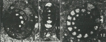 Nautiloculina oolithica Mohler, 1938