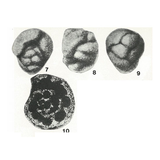 Globivalvulinella grossheimi Bukalova, 1957 Globivalvulinella grossheimi Bukalova, 1957